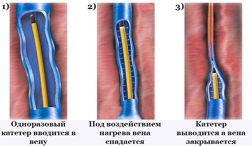 Почему одноразовые поды вкуснее?