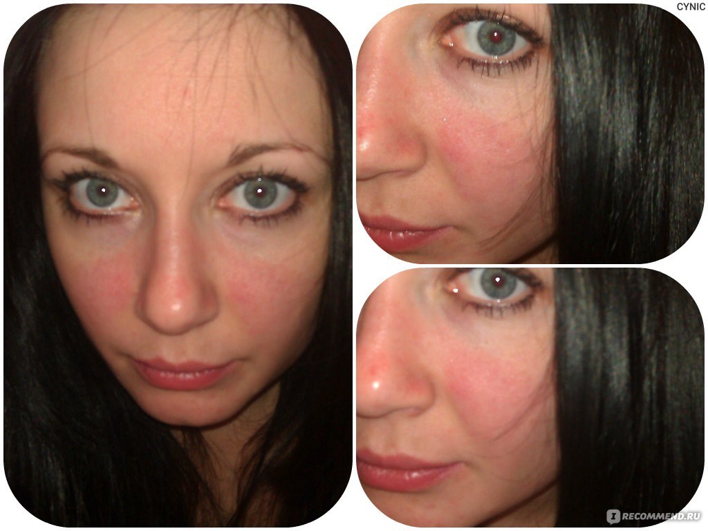 Можно ли курить Вейп аллергикам?